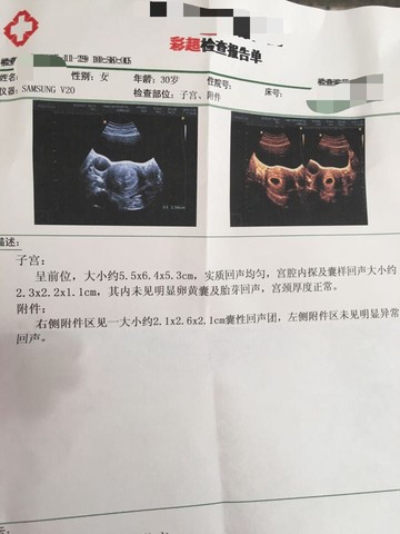 journal_insert_pic_351118462