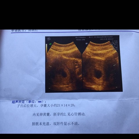 journal_insert_pic_354121639