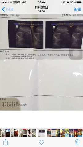 journal_insert_pic_358720481