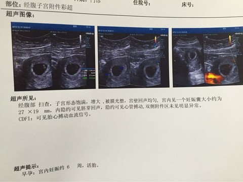 journal_insert_pic_361805413