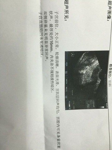 journal_insert_pic_363319144