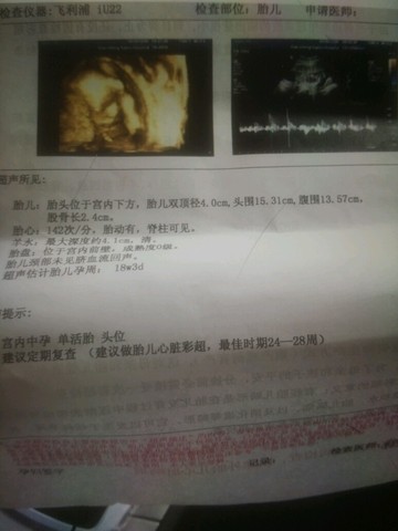 journal_insert_pic_374300101