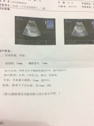 journal_insert_pic_377205576