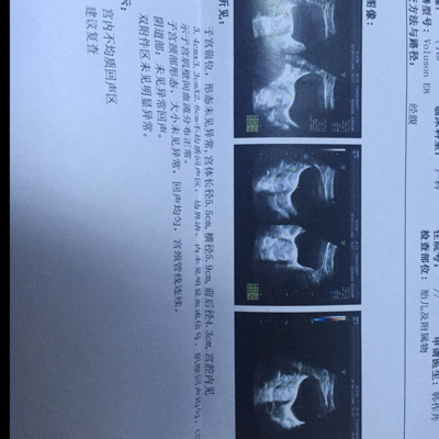 journal_insert_pic_380845855