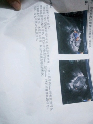 journal_insert_pic_381644120