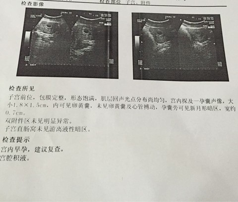 journal_insert_pic_381142750