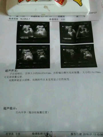 journal_insert_pic_387308842