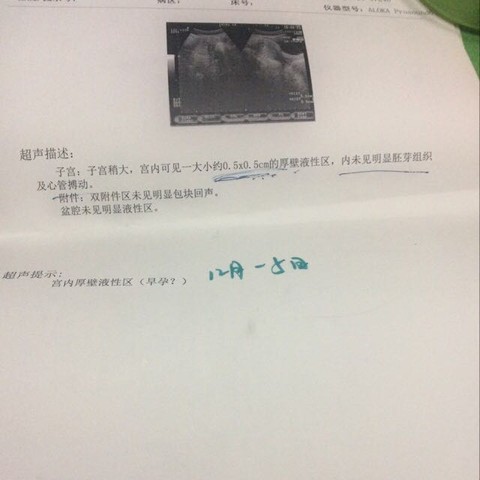 journal_insert_pic_388043521
