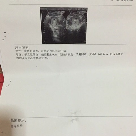 journal_insert_pic_388270660