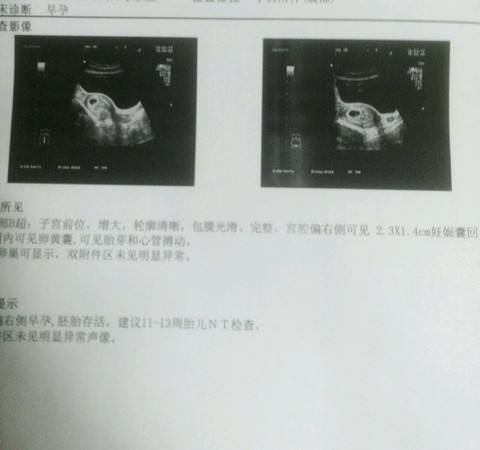 journal_insert_pic_390046913