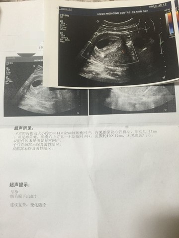 journal_insert_pic_390722186