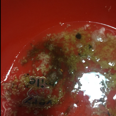 嘴裏感觉惺惺的.胃里存不下任何食物.胃还特别疼.怎麼办