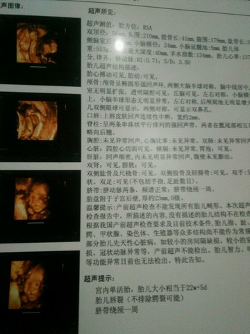 journal_insert_pic_394140079