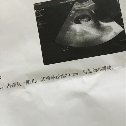 journal_insert_pic_397049473