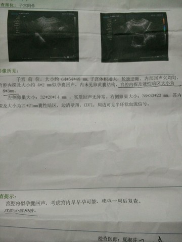 journal_insert_pic_397151200