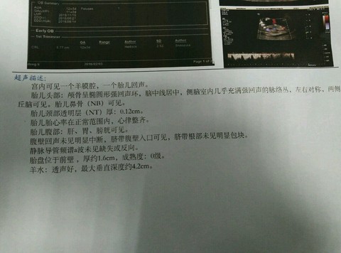 journal_insert_pic_399797524