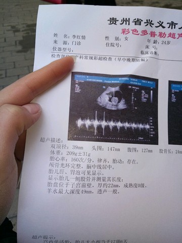 journal_insert_pic_400560359