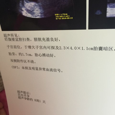 journal_insert_pic_404101102