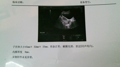 journal_insert_pic_405009414