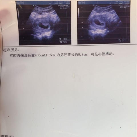 journal_insert_pic_409546113