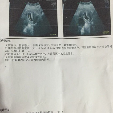 怀孕8周孕酮24算低吗_宝宝树