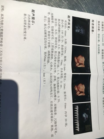 journal_insert_pic_412517771