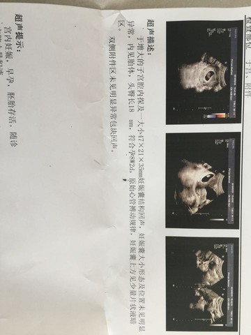 journal_insert_pic_414253363