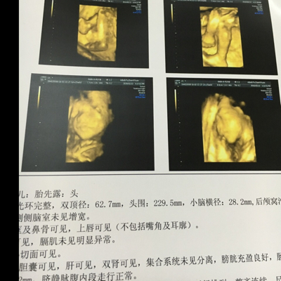 journal_insert_pic_414625822