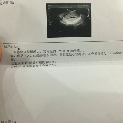 journal_insert_pic_416306659
