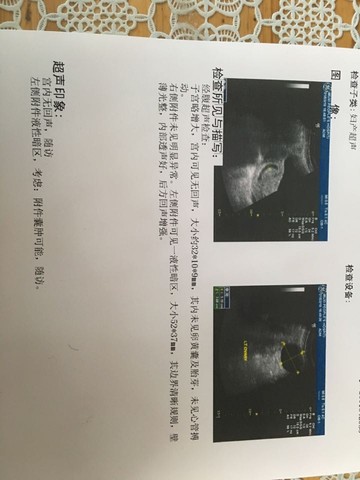 journal_insert_pic_416786424