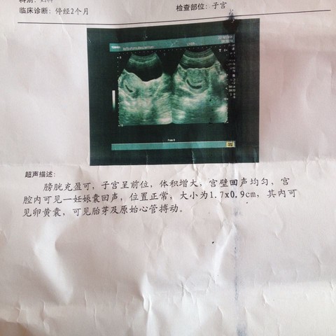 journal_insert_pic_418939250