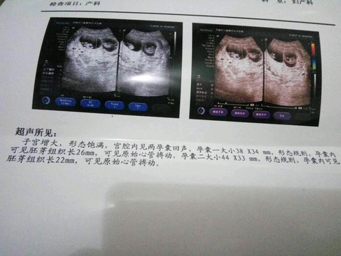 journal_insert_pic_418629200