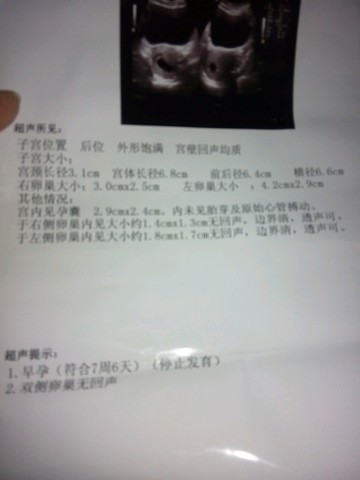 journal_insert_pic_420264128