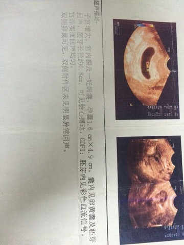 journal_insert_pic_421315027