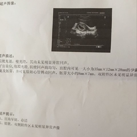journal_insert_pic_427329686