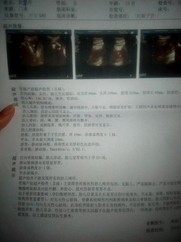 journal_insert_pic_427479050