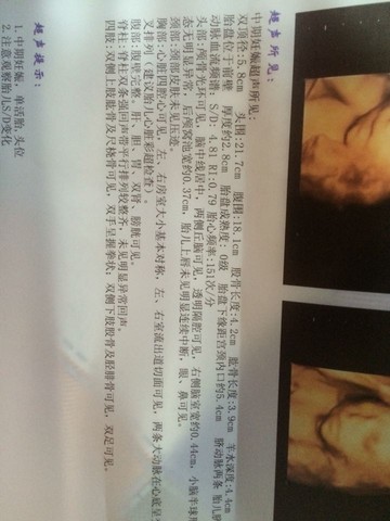 journal_insert_pic_427507125