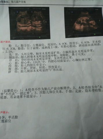 journal_insert_pic_428053241