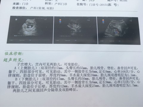 journal_insert_pic_430539364