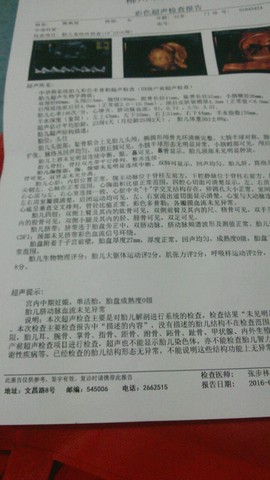 journal_insert_pic_434553587