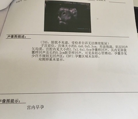 journal_insert_pic_435688795