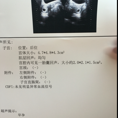 journal_insert_pic_437861179