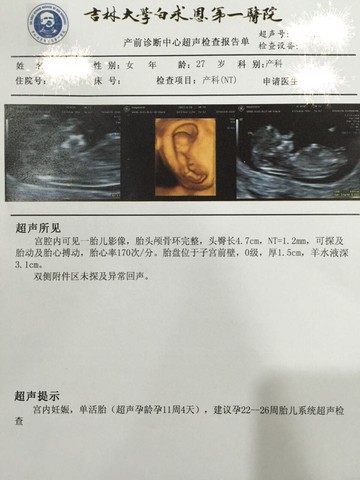 journal_insert_pic_438594223