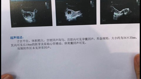 journal_insert_pic_440211571