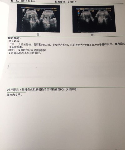 journal_insert_pic_440092749