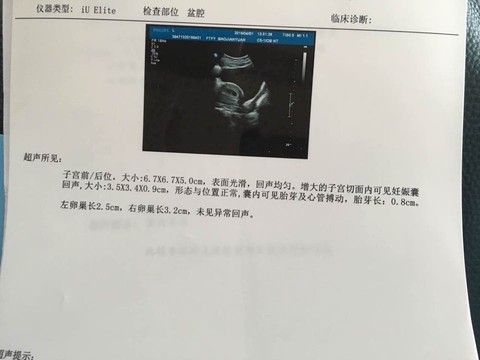 journal_insert_pic_441715831