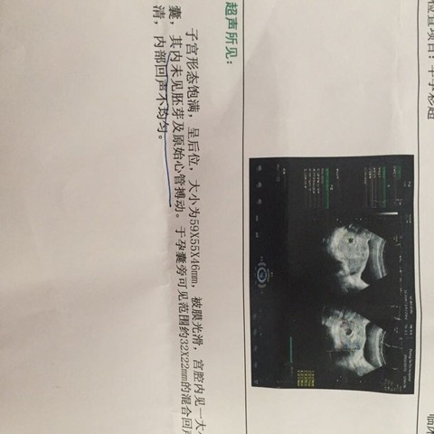 journal_insert_pic_441513390