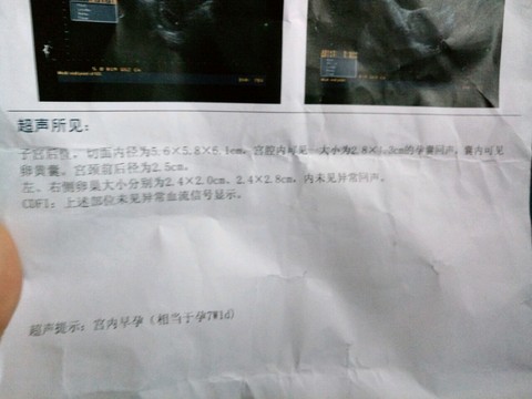 journal_insert_pic_442575587