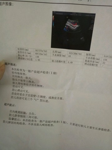 journal_insert_pic_442330224