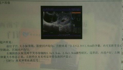 journal_insert_pic_443043934
